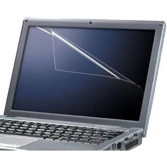 Laptop Skin Protector Pack 4 In 1 To-401